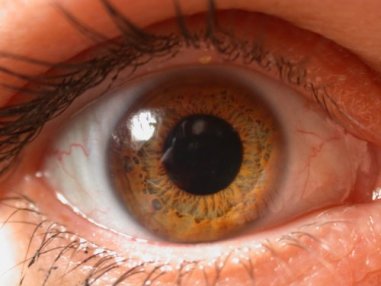 ojo